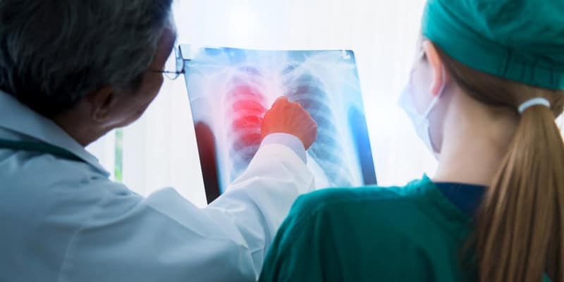 The Role of Pulmonologists